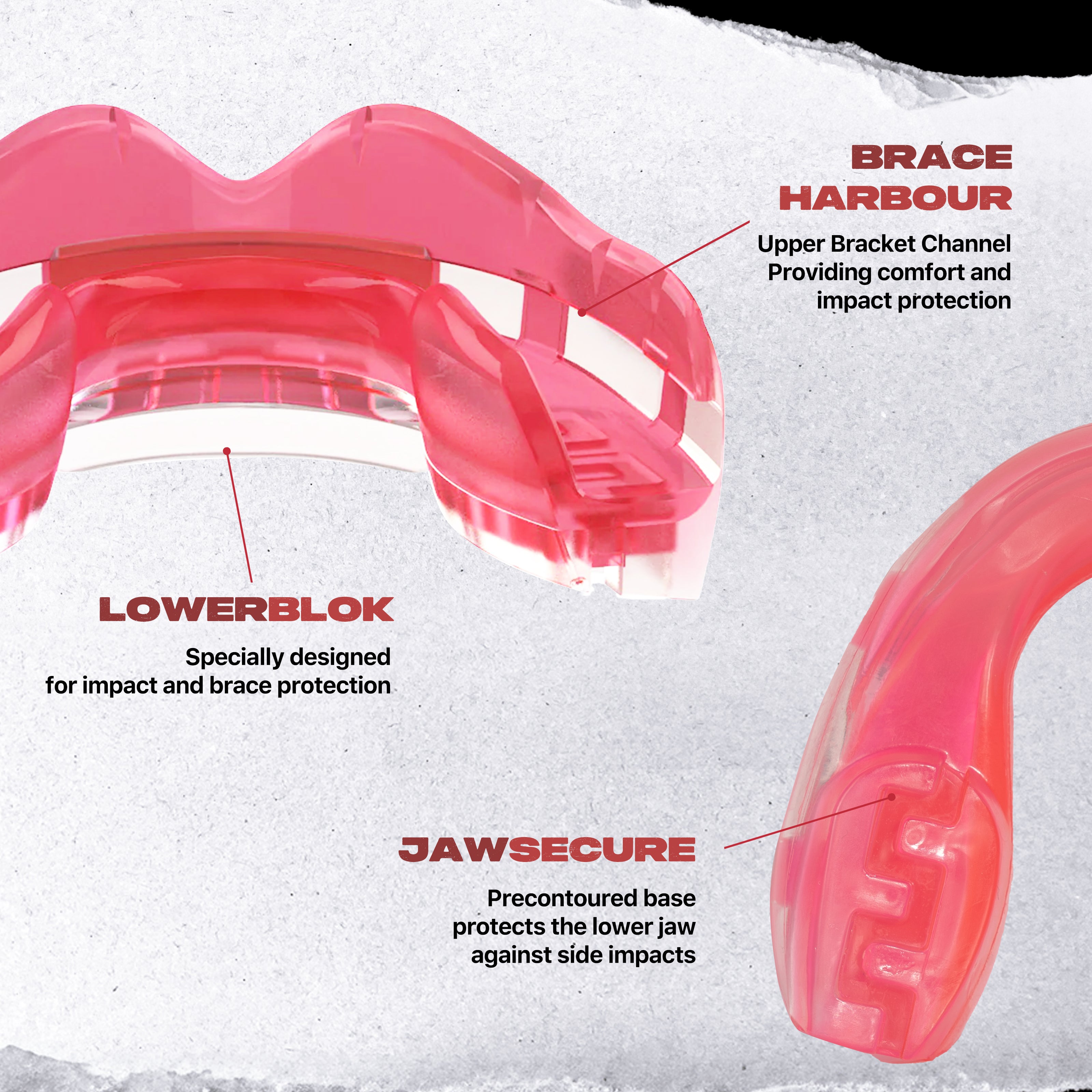 SAFEJAWZ® Ortho Series Mouthguard for Braces - Ice Pink