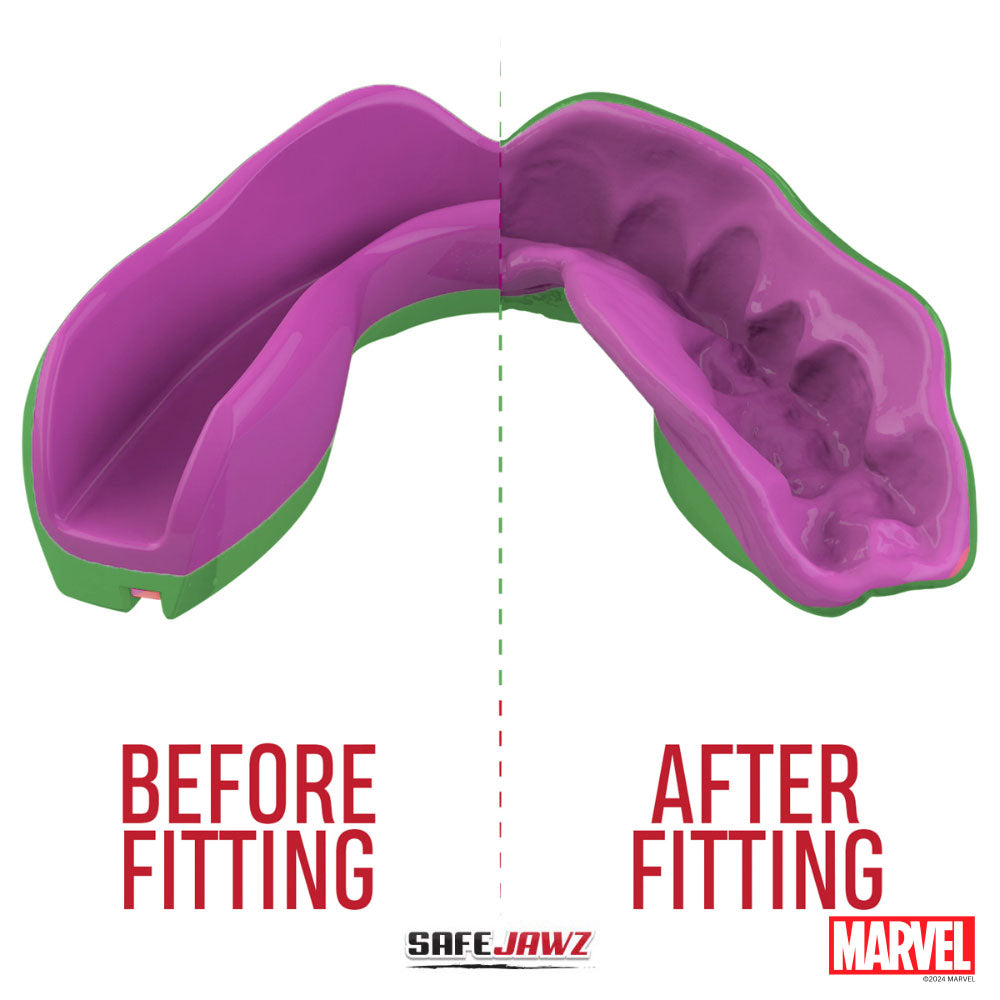 SafeJawz Marvel The Hulk Mouthguard